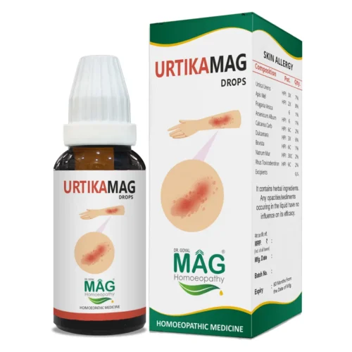 UrtikaMag - Urticaria & Hives Relief
