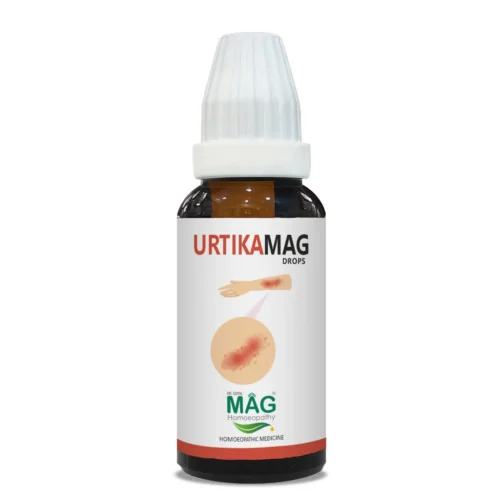 UrtikaMag - Urticaria & Hives Relief