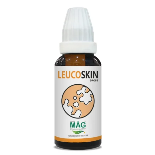 LeucoSkin - Vitiligo & White Patch Care