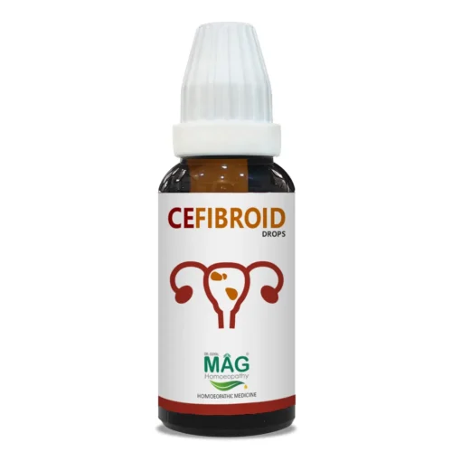 CeFibroid - Uterine Fibroid Care